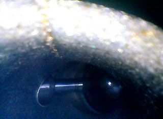 利用HIE系列內窺鏡檢測到的某4s店發動機進氣道圖片